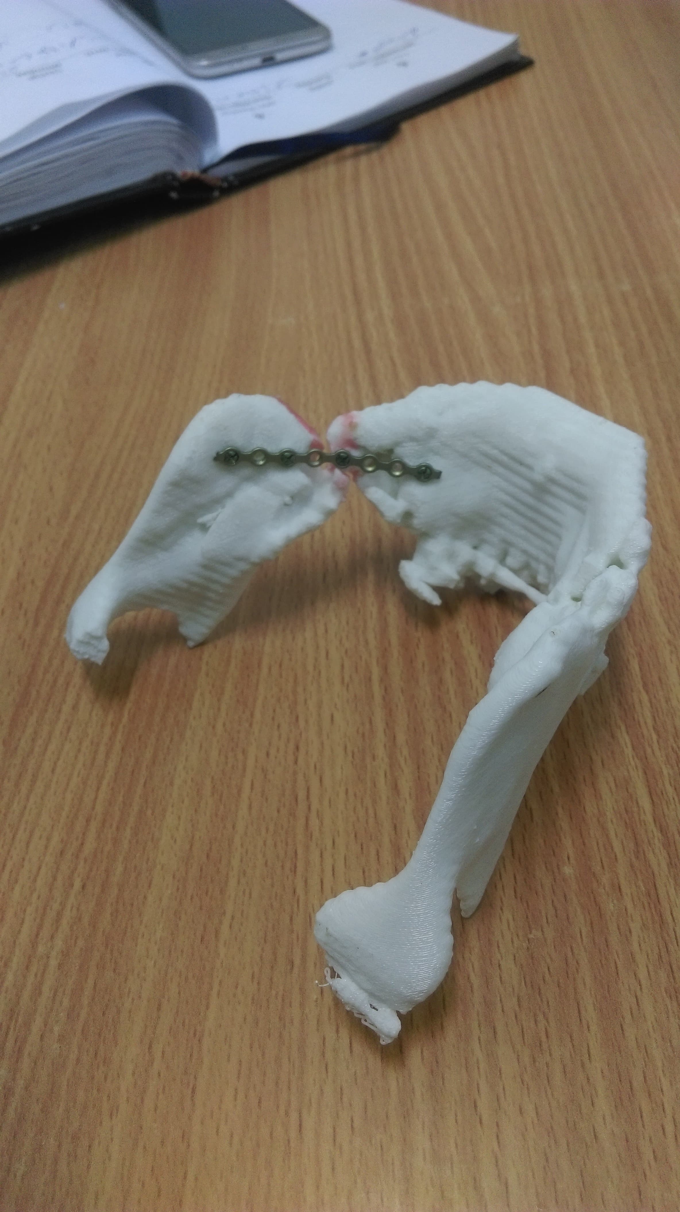 Dental medical model